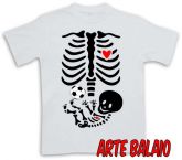 Raio X Boleiro